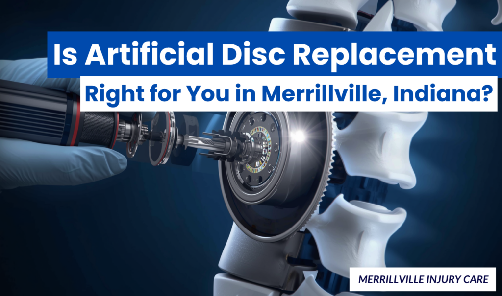Disc Replacement Merrillville