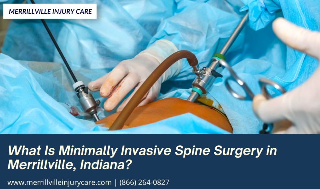 Minimally Invasive Spine Surgery Merrillville